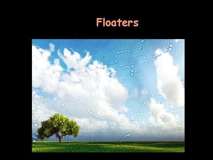 Floaters 