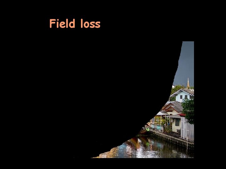 Field loss 