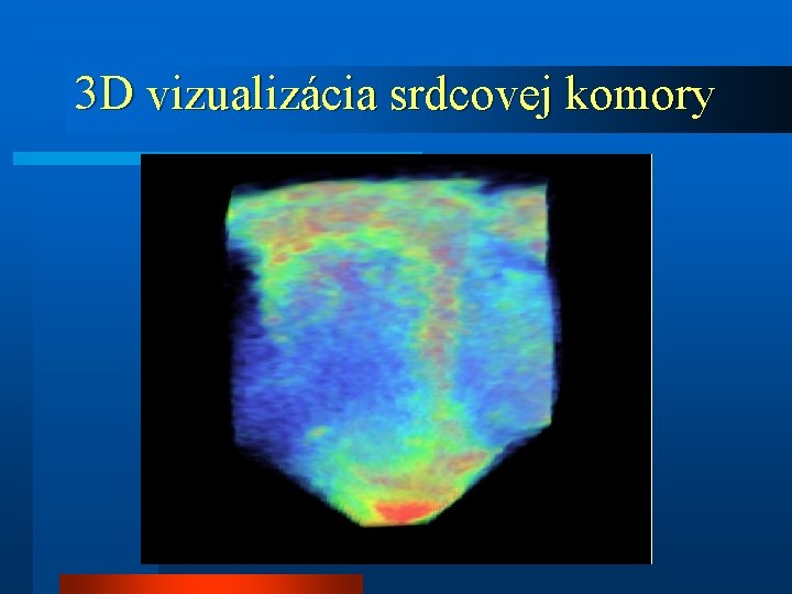 3 D vizualizácia srdcovej komory 