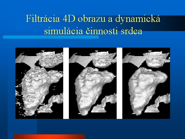 Filtrácia 4 D obrazu a dynamická simulácia činnosti srdca 