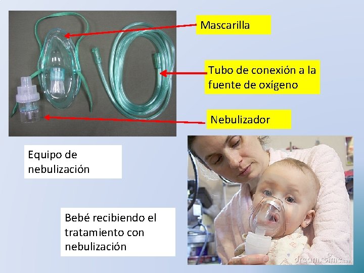 Mascarilla Tubo de conexión a la fuente de oxígeno Nebulizador Equipo de nebulización Bebé