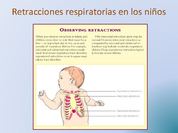 Retracciones respiratorias en los niños 