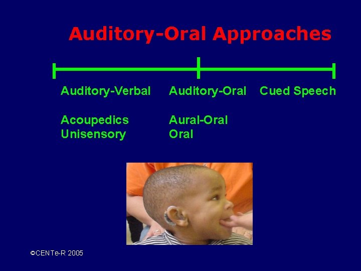 Auditory-Oral Approaches Auditory-Verbal Auditory-Oral Acoupedics Unisensory Aural-Oral ©CENTe-R 2005 Cued Speech 