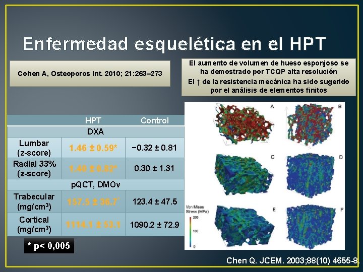 Enfermedad esquelética en el HPT Cohen A, Osteoporos Int. 2010; 21: 263– 273 Lumbar