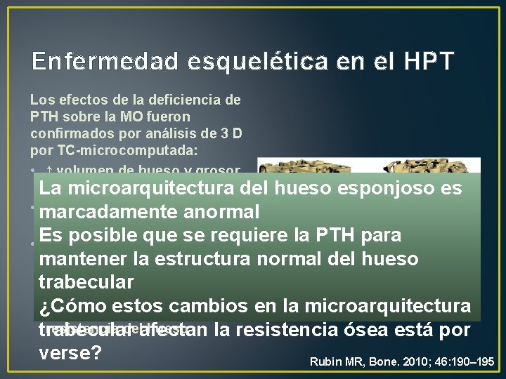 Enfermedad esquelética en el HPT Los efectos de la deficiencia de PTH sobre la