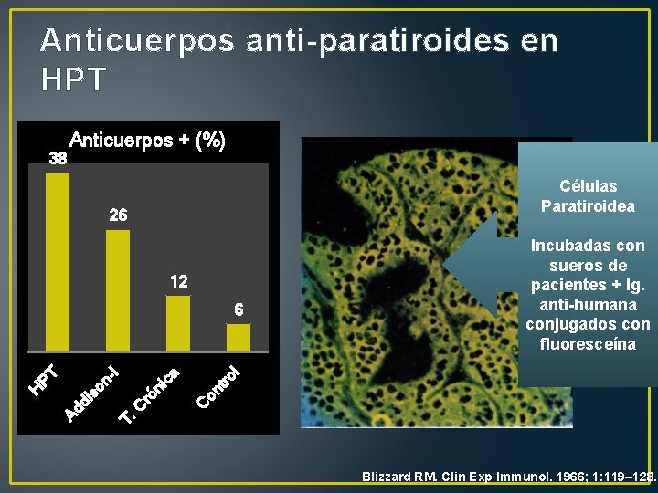Anticuerpos anti-paratiroides en HPT 38 Anticuerpos + (%) Células Paratiroidea 26 12 l C