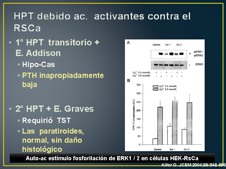 HPT debido ac. activantes contra el RSCa • 1° HPT transitorio + E. Addison