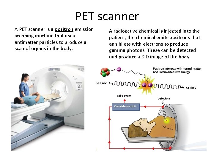 PET scanner A PET scanner is a positron emission scanning machine that uses antimatter PET scanner A PET scanner is a positron emission scanning machine that uses antimatter