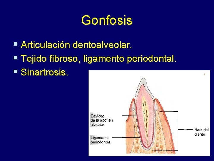Gonfosis § Articulación dentoalveolar. § Tejido fibroso, ligamento periodontal. § Sinartrosis. 