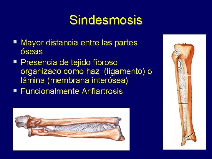 Sindesmosis § Mayor distancia entre las partes óseas § Presencia de tejido fibroso organizado