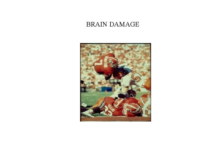 BRAIN DAMAGE 