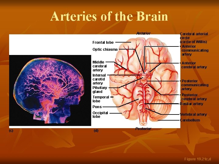 Arteries of the Brain Anterior Frontal lobe Optic chiasma Middle cerebral artery Internal carotid