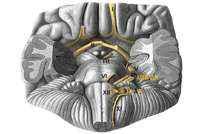 I II III V VII&VIII VI IX &X XII XI 
