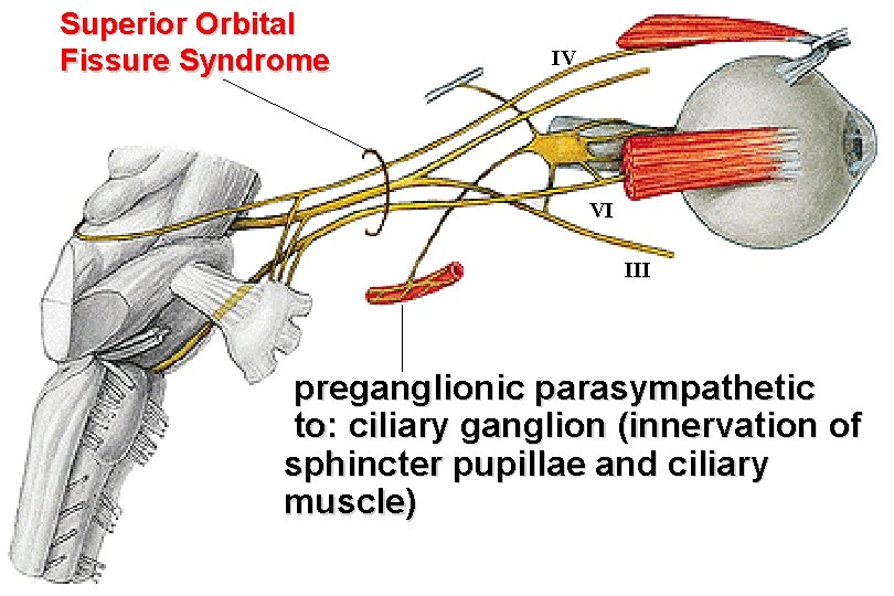 Superior Orbital Fissure Syndrome IV VI III preganglionic parasympathetic to: ciliary ganglion (innervation of