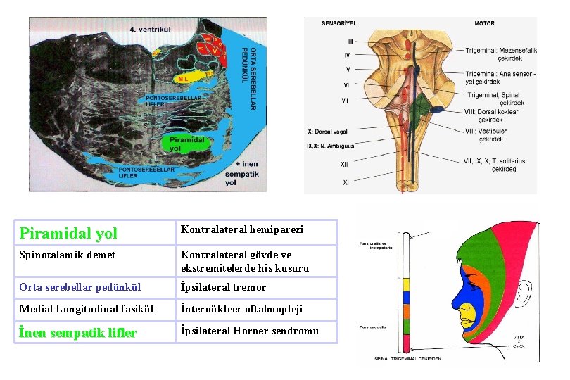 Piramidal yol Kontralateral hemiparezi Spinotalamik demet Kontralateral gövde ve ekstremitelerde his kusuru Orta serebellar
