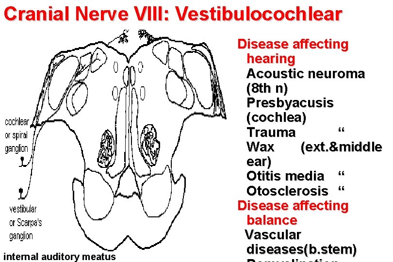 Cranial Nerve VIII: Vestibulocochlear internal auditory meatus Disease affecting hearing Acoustic neuroma (8 th