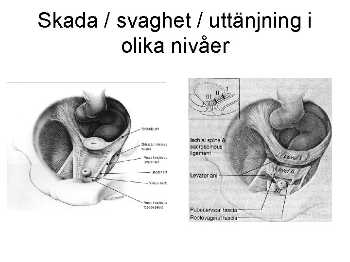 Skada / svaghet / uttänjning i olika nivåer 