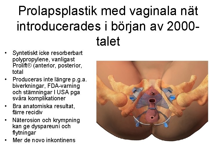 Prolapsplastik med vaginala nät introducerades i början av 2000 talet • Syntetiskt icke resorberbart