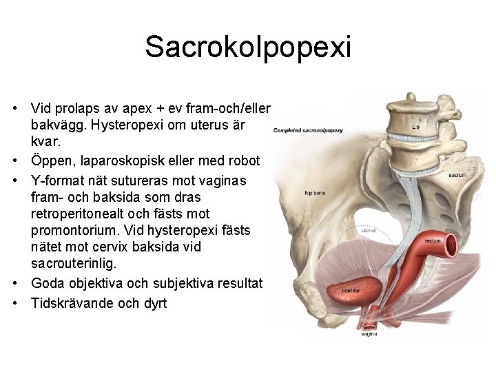 Sacrokolpopexi • Vid prolaps av apex + ev fram-och/eller bakvägg. Hysteropexi om uterus är