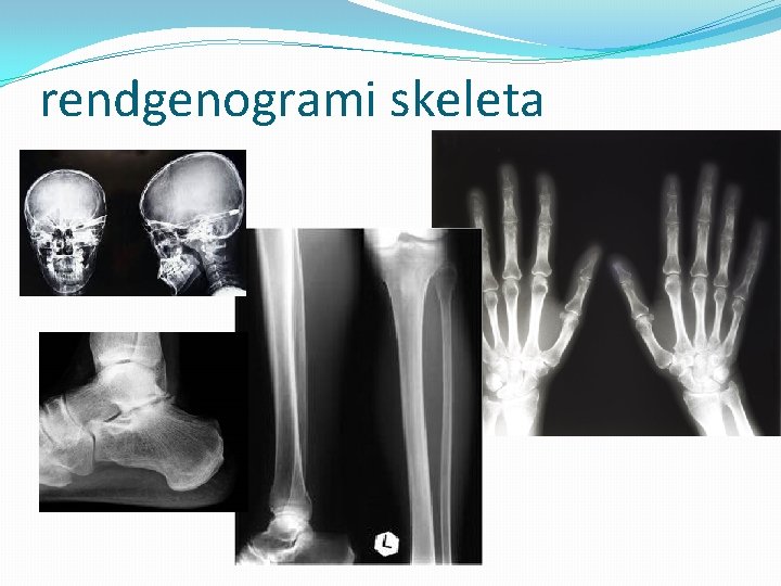 rendgenogrami skeleta 