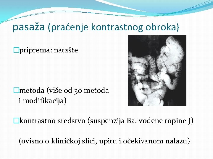 pasaža (praćenje kontrastnog obroka) �priprema: natašte �metoda (više od 30 metoda i modifikacija) �kontrastno