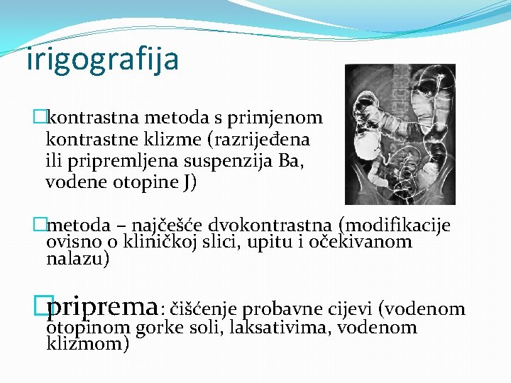 irigografija �kontrastna metoda s primjenom kontrastne klizme (razrijeđena ili pripremljena suspenzija Ba, vodene otopine