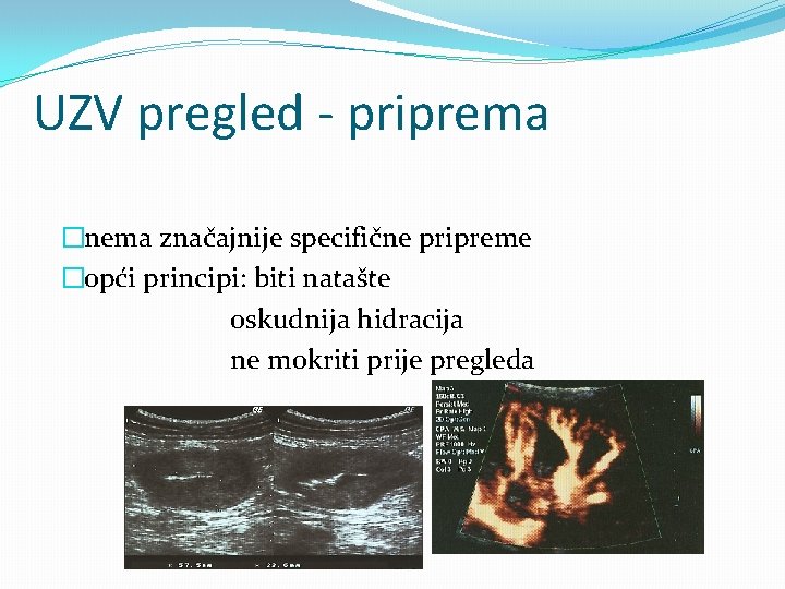 UZV pregled - priprema �nema značajnije specifične pripreme �opći principi: biti natašte oskudnija hidracija