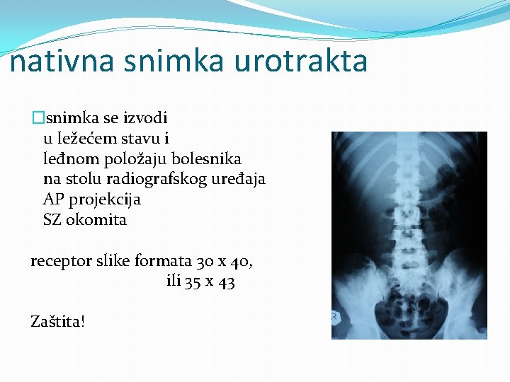 nativna snimka urotrakta �snimka se izvodi u ležećem stavu i leđnom položaju bolesnika na