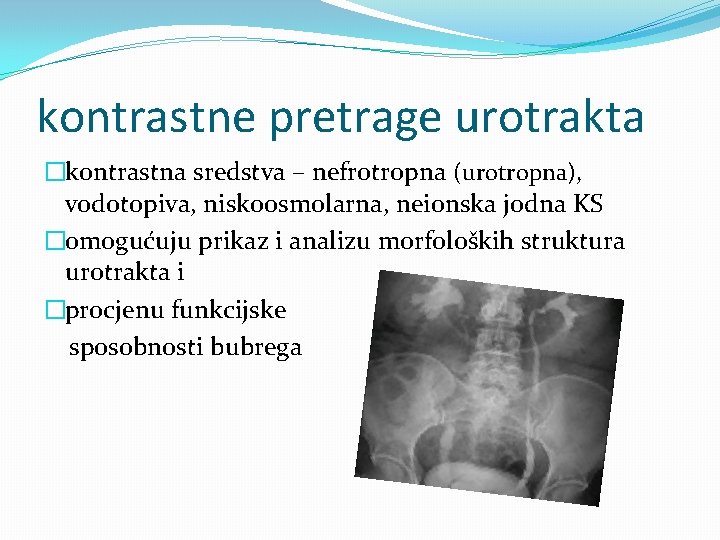kontrastne pretrage urotrakta �kontrastna sredstva – nefrotropna (urotropna), vodotopiva, niskoosmolarna, neionska jodna KS �omogućuju