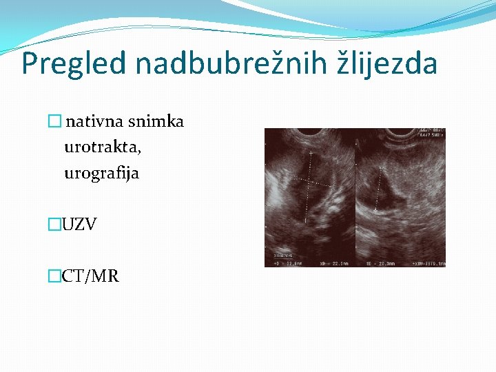 Pregled nadbubrežnih žlijezda � nativna snimka urotrakta, urografija �UZV �CT/MR 
