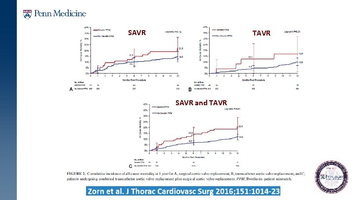 SAVR TAVR SAVR and TAVR 