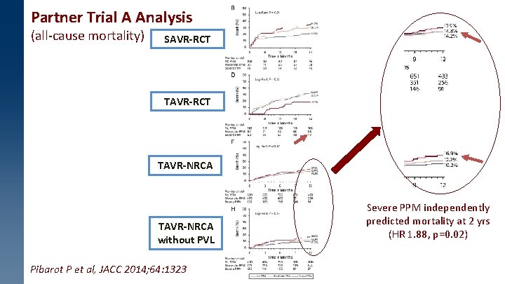 Partner Trial A Analysis (all-cause mortality) SAVR-RCT TAVR-NRCA without PVL Pibarot P et al,
