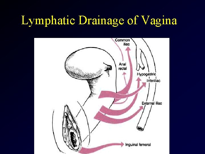 Lymphatic Drainage of Vagina 