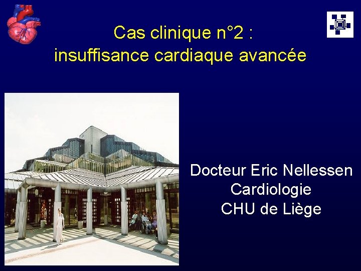 Cas clinique n° 2 : insuffisance cardiaque avancée Docteur Eric Nellessen Cardiologie CHU de