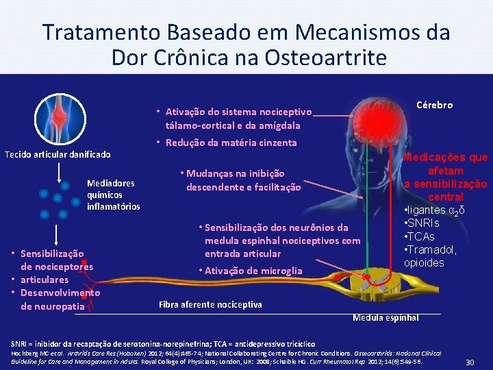 Tratamento Baseado em Mecanismos da Dor Crônica na Osteoartrite Cérebro • Ativação do sistema