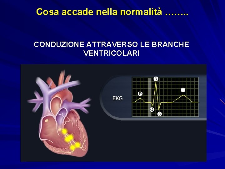 Cosa accade nella normalità ……. . CONDUZIONE ATTRAVERSO LE BRANCHE VENTRICOLARI 