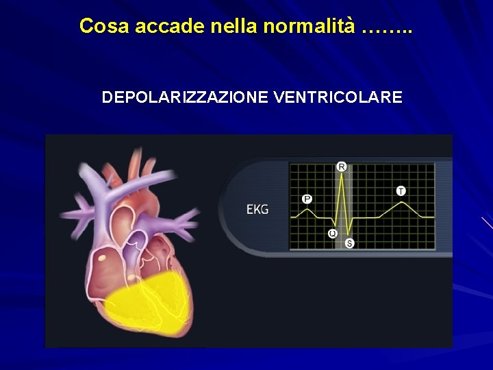 Cosa accade nella normalità ……. . DEPOLARIZZAZIONE VENTRICOLARE 