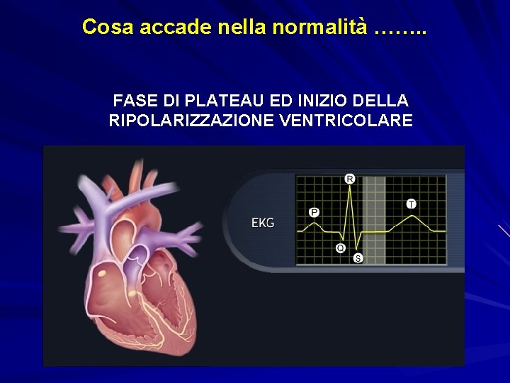 Cosa accade nella normalità ……. . FASE DI PLATEAU ED INIZIO DELLA RIPOLARIZZAZIONE VENTRICOLARE