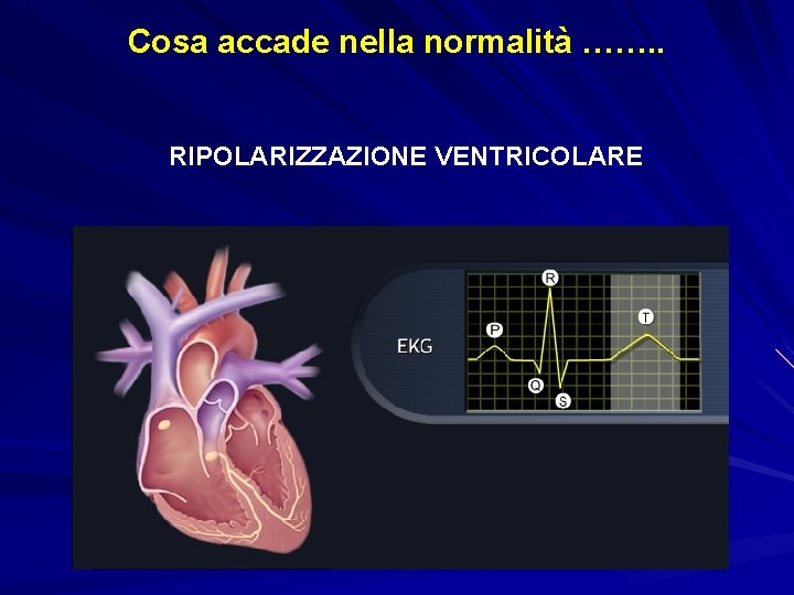 Cosa accade nella normalità ……. . RIPOLARIZZAZIONE VENTRICOLARE 