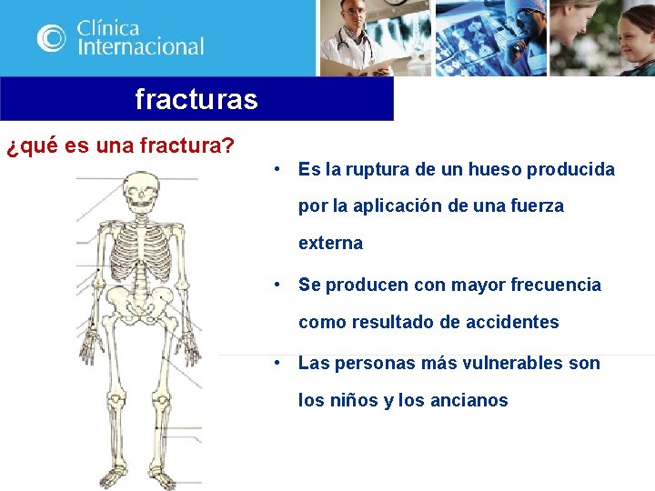 fracturas ¿qué es una fractura? • Es la ruptura de un hueso producida por