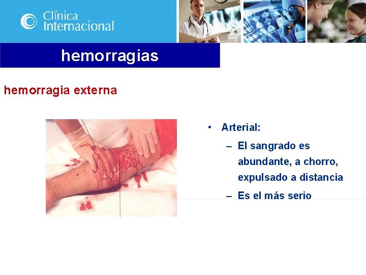 hemorragias hemorragia externa • Arterial: – El sangrado es abundante, a chorro, expulsado a