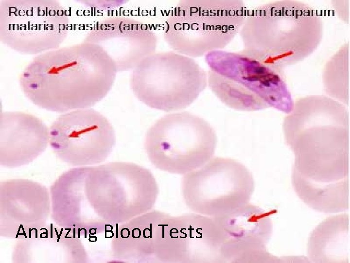 Analyzing Blood Tests 