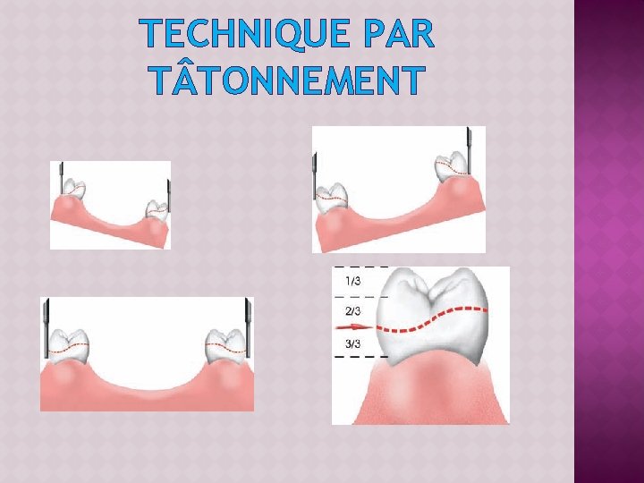 TECHNIQUE PAR T TONNEMENT 