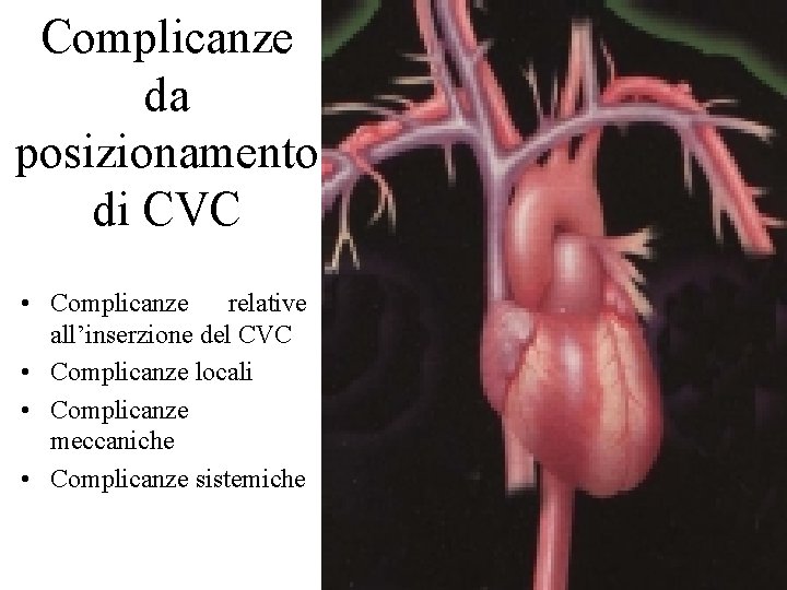 Complicanze da posizionamento di CVC • Complicanze relative all’inserzione del CVC • Complicanze locali