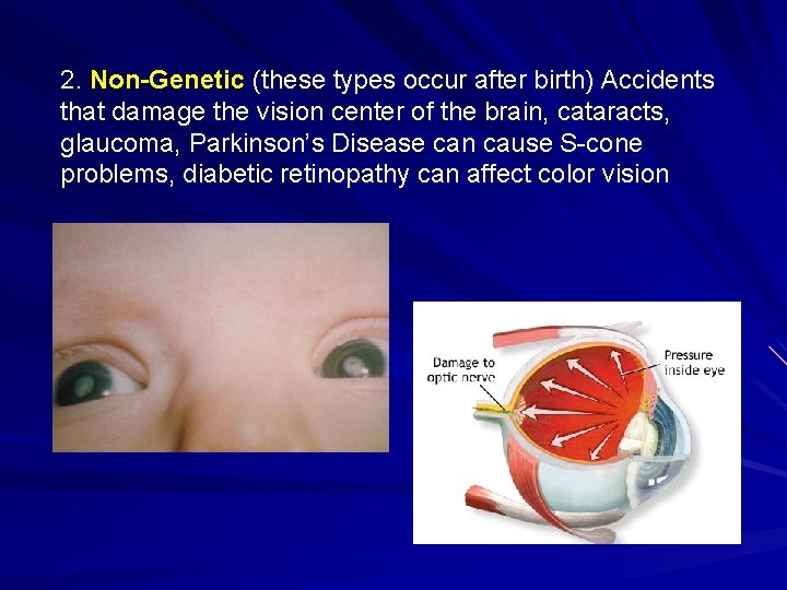 2. Non-Genetic (these types occur after birth) Accidents that damage the vision center of