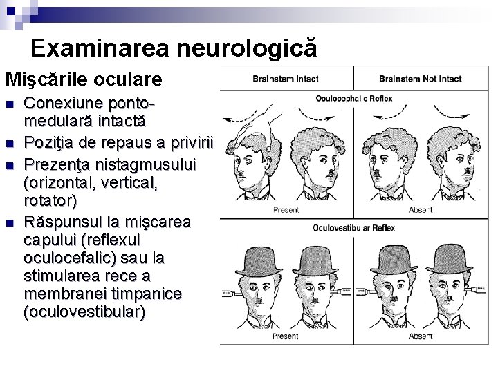 Examinarea neurologică Mişcările oculare n n Conexiune pontomedulară intactă Poziţia de repaus a privirii Examinarea neurologică Mişcările oculare n n Conexiune pontomedulară intactă Poziţia de repaus a privirii