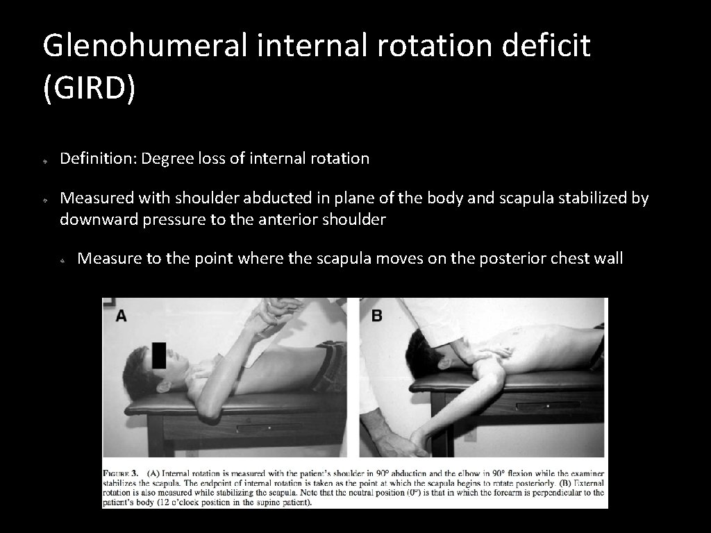 Glenohumeral internal rotation deficit (GIRD) Definition: Degree loss of internal rotation Measured with shoulder