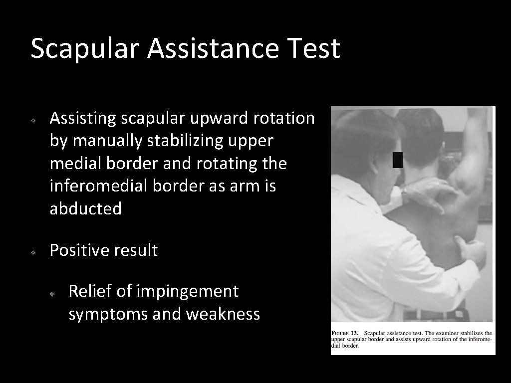 Scapular Assistance Test Assisting scapular upward rotation by manually stabilizing upper medial border and