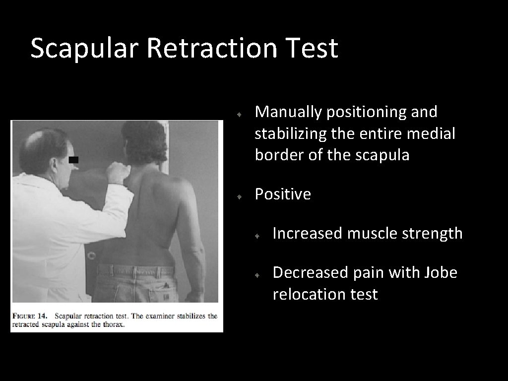 Scapular Retraction Test Manually positioning and stabilizing the entire medial border of the scapula