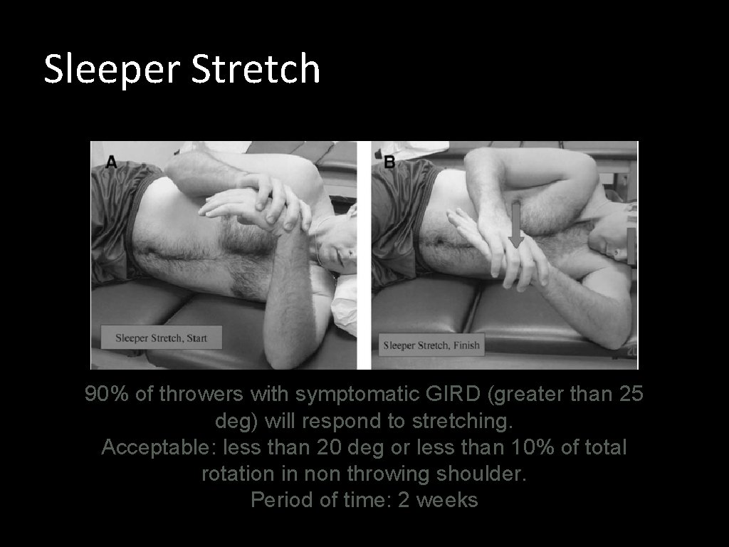 Sleeper Stretch 90% of throwers with symptomatic GIRD (greater than 25 deg) will respond